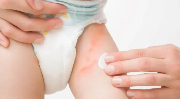 Skąd wiadomo, że pampers jest za mały? Rozpoznaj objawy!